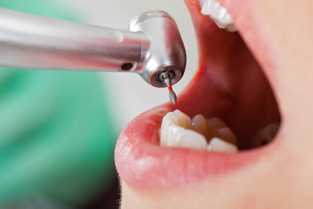 Best Broken or Chipped Tooth Repair in Cold Spring Harbor, NY